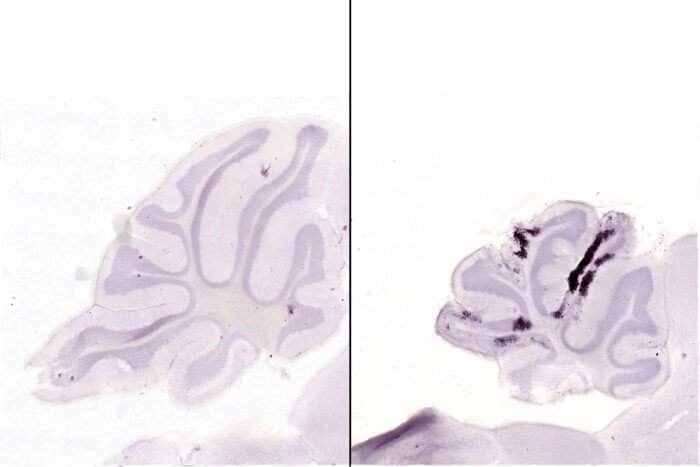 ep las manchas purpuras oscuras indican neuronas moribundas el cerebro de un raton infectado con una