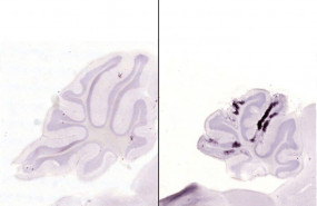 ep las manchas purpuras oscuras indican neuronas moribundas el cerebro de un raton infectado con una
