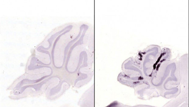 ep las manchas purpuras oscuras indican neuronas moribundas el cerebro de un raton infectado con una