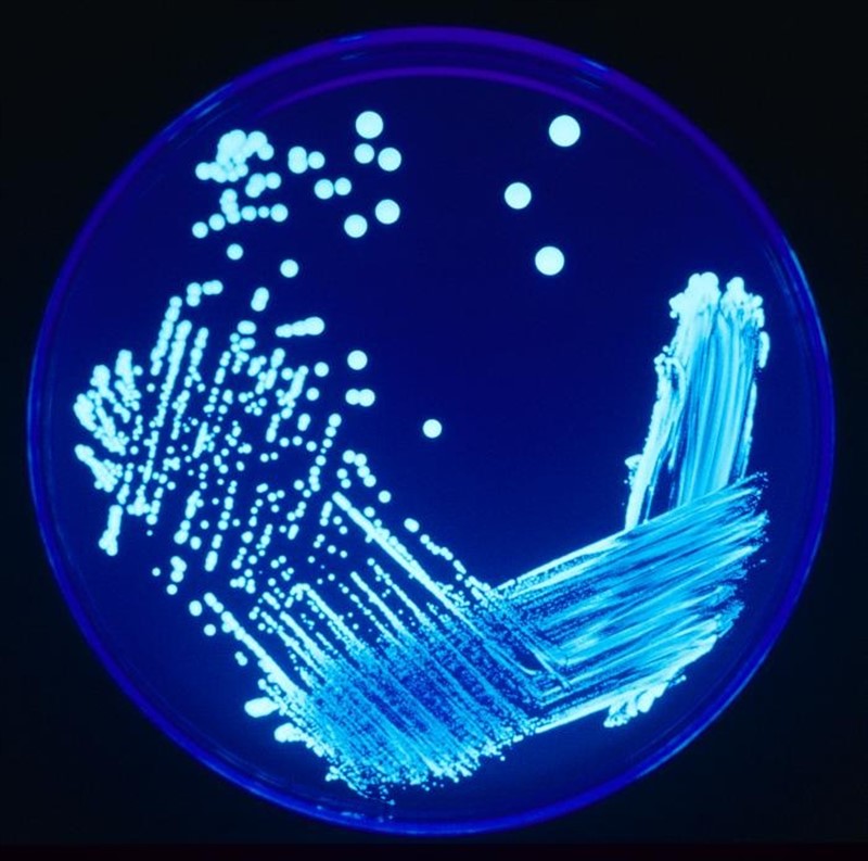 Legionella | ANECPLA - Archivo ep legionella