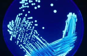 ep legionella