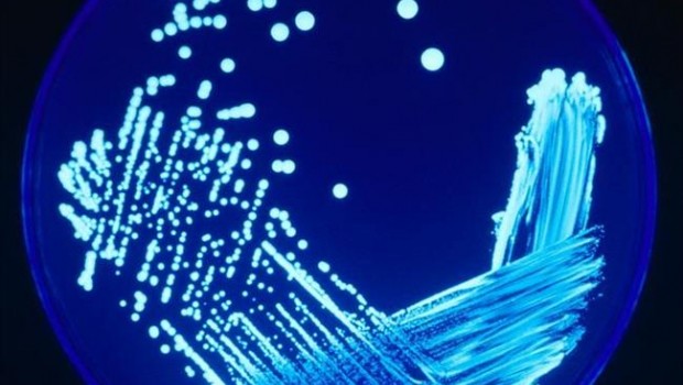 ep legionella