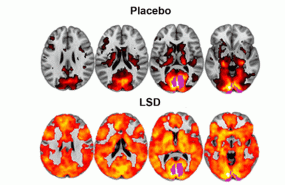 zzzzlsd
