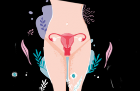 1637049038 02 c ncer de c rvix