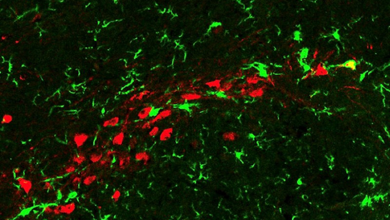 Las neuronas de dopamina senescentes (rojas) desencadenan una inflamación local y son atacadas por las células inmunitarias del cerebro, la microglia (verde). | THE ROCKEFELLER UNIVERSITY ep las neuronas de dopamina senescentes rojas desencadenan una inflamacion local y son atacadas por