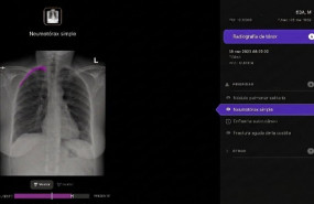 ep radiografia ep radiografia