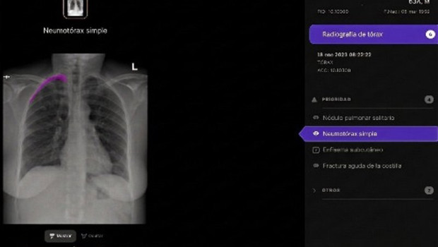 ep radiografia ep radiografia