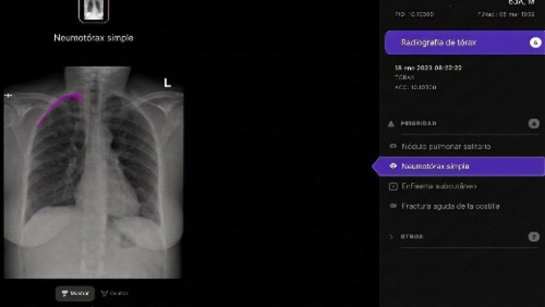 ep radiografia ep radiografia
