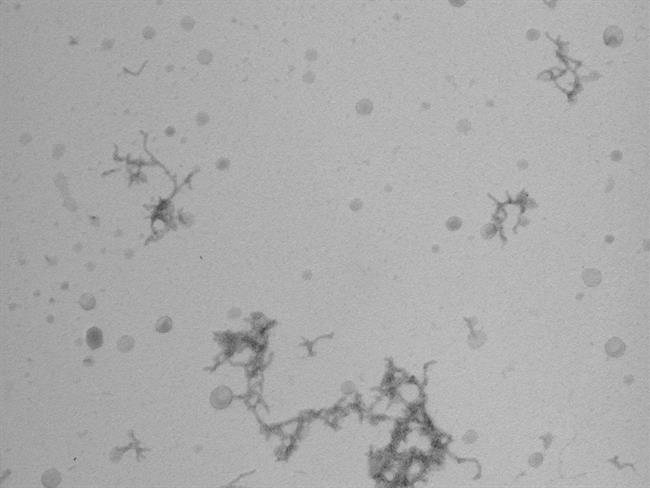 Imagen de microscopia de cúmulos de proteínas beta-amiloide 'in vitro' | IRB BARCELONA / BERNAT SERRA-VIDAL ep imagenmicroscopiacumulosproteinas beta-amiloide in vitro