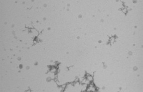 ep imagenmicroscopiacumulosproteinas beta-amiloide in vitro