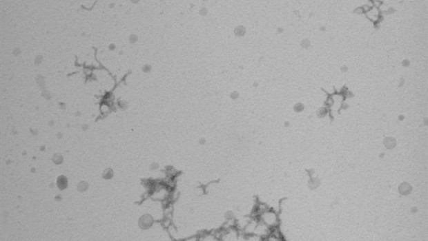 ep imagenmicroscopiacumulosproteinas beta-amiloide in vitro