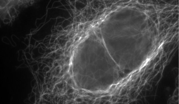 Los microtúbulos son el esqueleto de las células, les dan forma y regulan la división | CSIC ep los microtubulos son el esqueleto de las celulas les dan forma y regulan la division