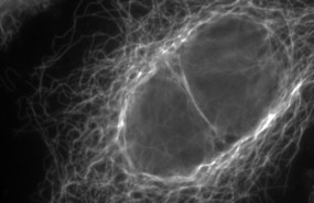 ep los microtubulos son el esqueleto de las celulas les dan forma y regulan la division