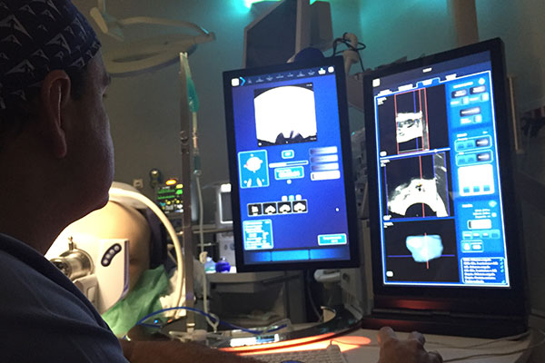 1644250383 hifu ultrasonido focalizado de alta intensidad 1 png 2