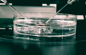ep fecundacion in vitro 20200219120305
