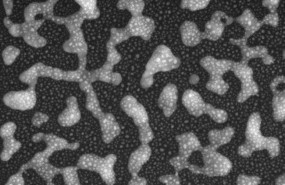 ep una imagenmicroscopio electronicobarrido muestrasuperficieun nue