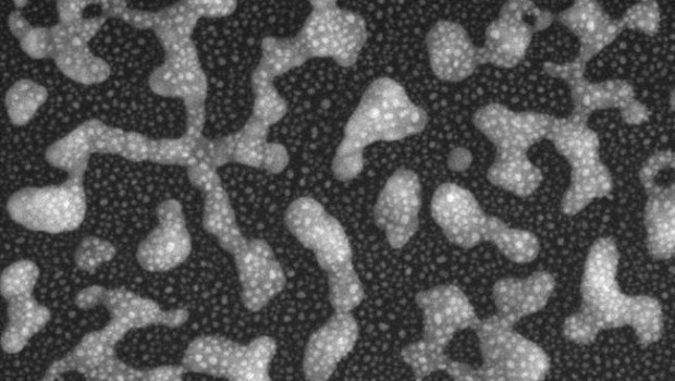 ep una imagenmicroscopio electronicobarrido muestrasuperficieun nue
