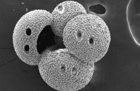ep imagen de microscopio electronico de uno de los microfosiles planctonicos analizados para el
