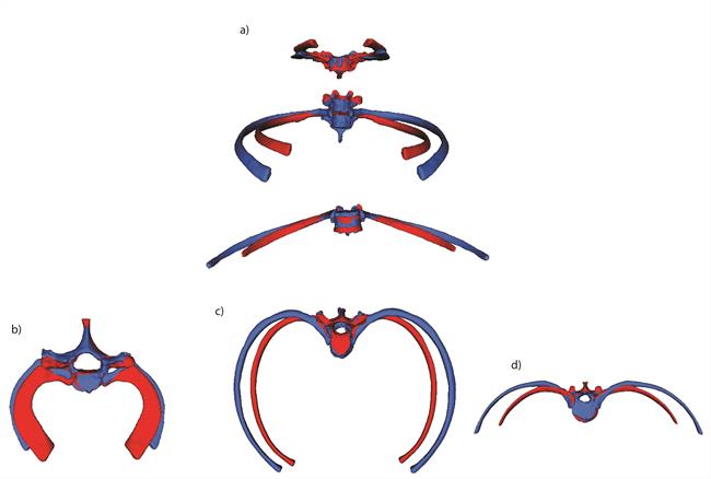 ep torax neardental