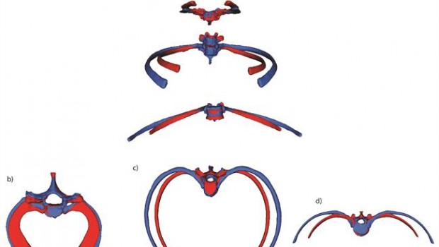 ep torax neardental