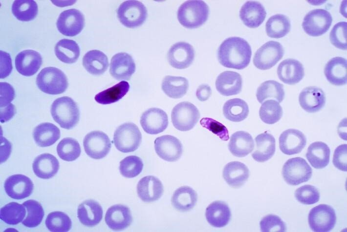 Plasmodium falciparum, un parásito que causa la malaria cerebral. | THE GLOBAL PANORAMA - Archivo ep plasmodium falciparum un parasito que causa la malaria cerebral