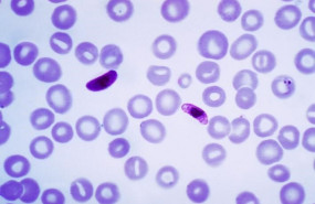 ep plasmodium falciparum un parasito que causa la malaria cerebral