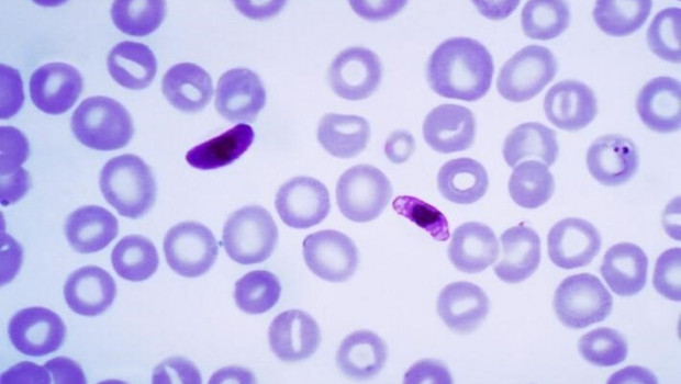 ep plasmodium falciparum un parasito que causa la malaria cerebral
