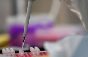 ep un investigador trabaja en un laboratorio del centro de prevencion y control de enfermedades en ep un investigador trabaja en un laboratorio del centro de prevencion y control de enfermedades en