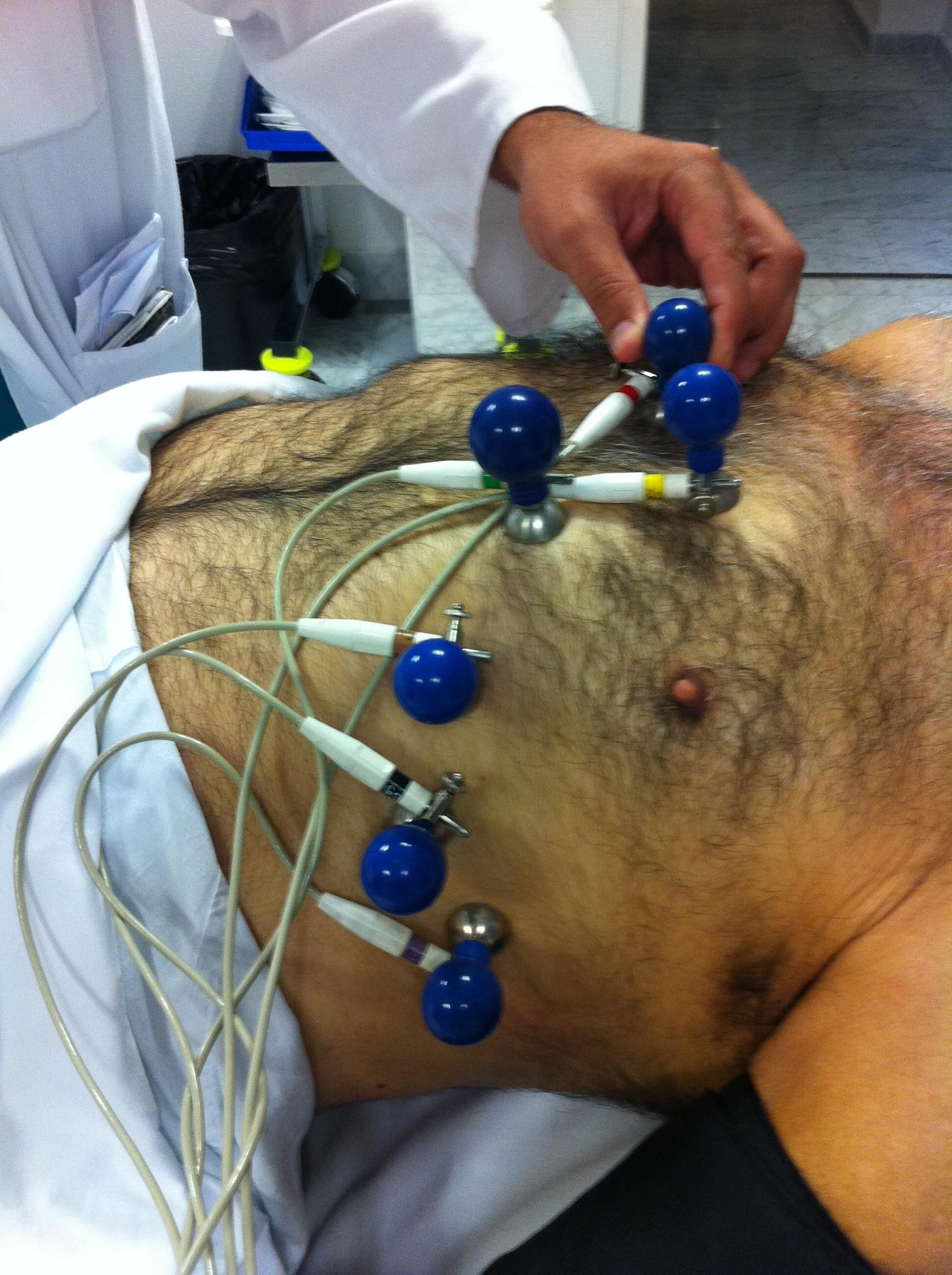 Tratamiento para la insuficiencia cardiáca | CEDIDA - Archivo ep tratamientola insuficiencia cardiaca