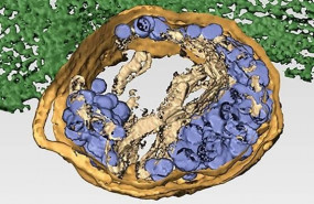 ep tomografia electronica tridimensional de una celula infectada por el reovirus humano los virus