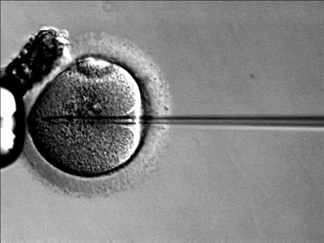 Reproducción asistida, óvulo, fecundación | CREATIVE COMMONS ep reproduccion asistida ovulo fecundacion