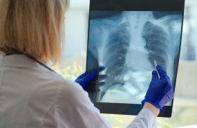 epoc en tamano grande