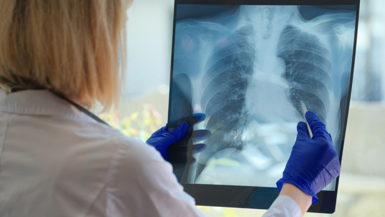 epoc en tamano grande