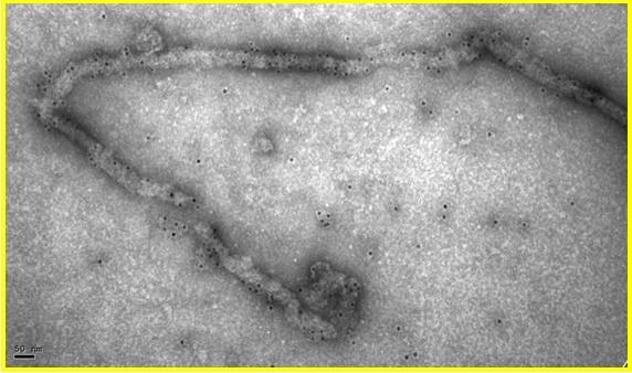 Virus del ébola | CSIC ep virus del ebola 20180527160003