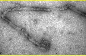 ep virus del ebola 20180527160003
