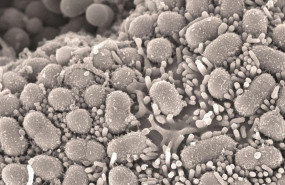 ep micrografia electronicabarridointestinoraton infectado con staphylococcus aureus