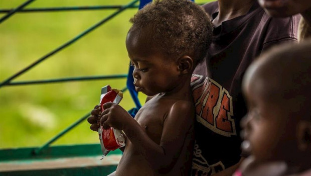 ep un nino desnutrido en republica democratica del congo
