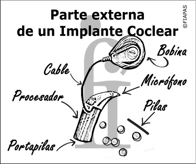 ep implante coclear