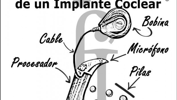 ep implante coclear