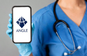 dl angle aim parsortix medical biopsy technology developer healthcare medicine logo