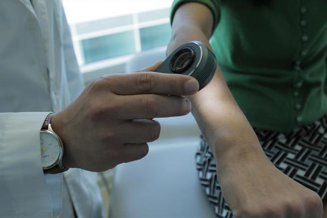 ep dermatologo analizapieluna paciente
