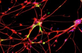 ep neuronas 20170322111213