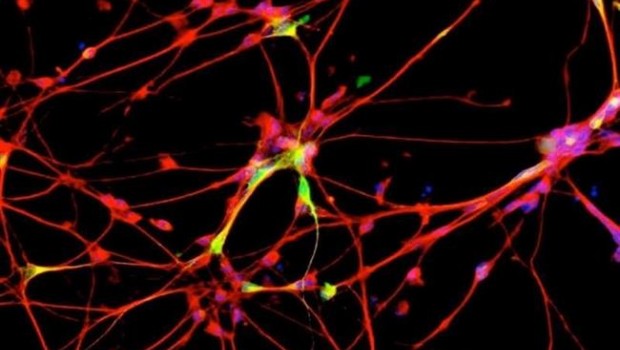 ep neuronas 20170322111213