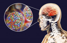 1597822619 virus del nilo comunicae