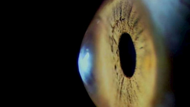 ep la cornea la lente mas externa del ojo se debilita con el paso del tiempo