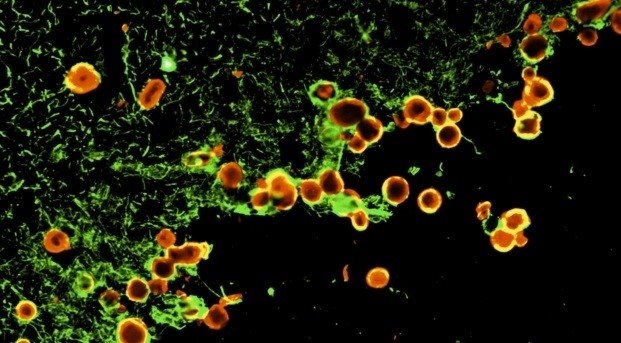 ep la funcion de los cuerpos amilaceos es eliminar sustancias de desecho cerebrales