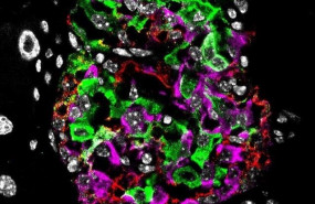 ep nucleo celular en blanco celulas beta e insulina en verde celulas alfa hormona glucagon en rojo y